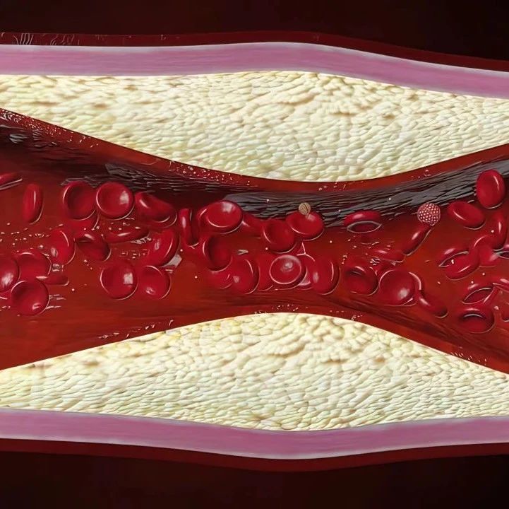 WTDay24丨世界血栓日：携手行动，共筑健康防线'